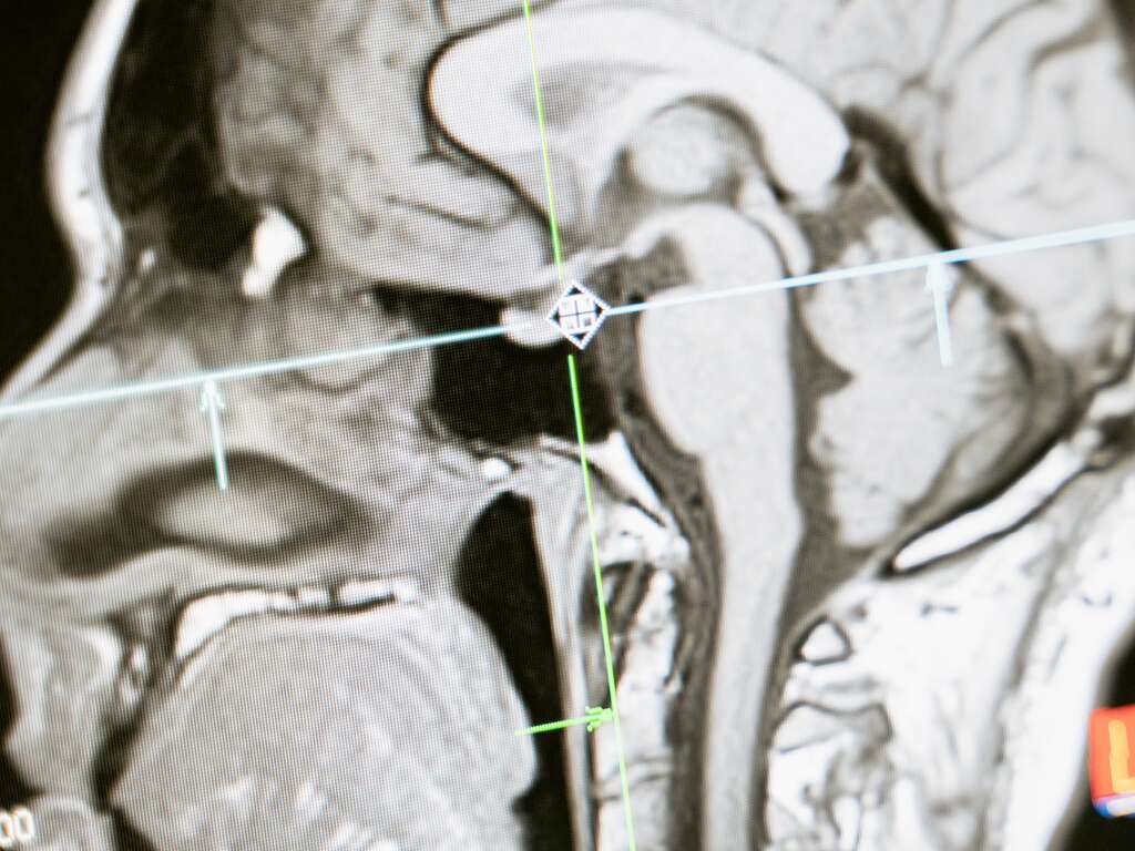 Central Nervous System | Care Plus NJ