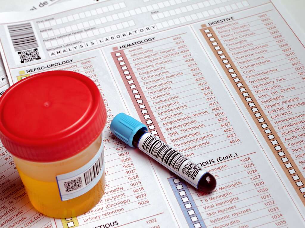 How Long Does Fentanyl Stay In Your System? | Care Plus NJ